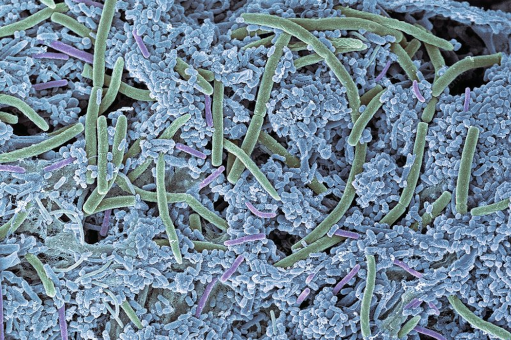 Mesosil’s infection-fighting dental tech gets FDA clearance | BetaKit