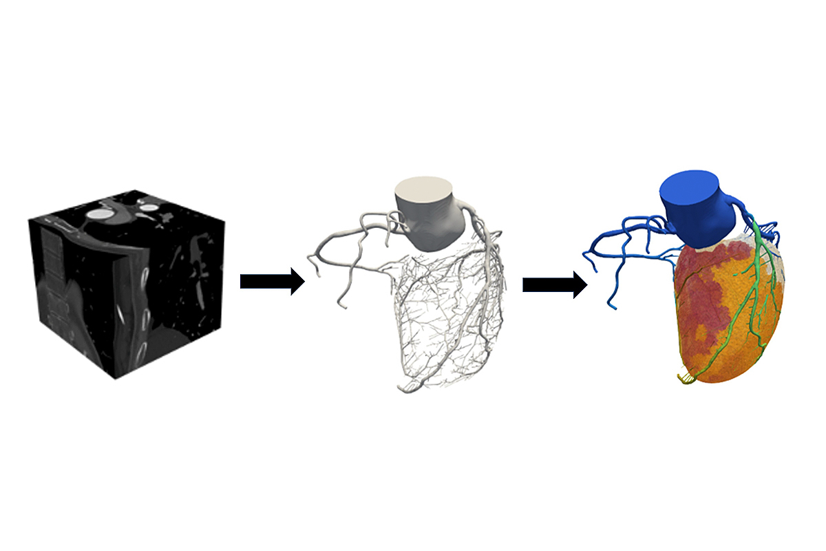 New UT Venture Studio Accelerates Market-Ready Startups To Treat Patients Using Digital Twins