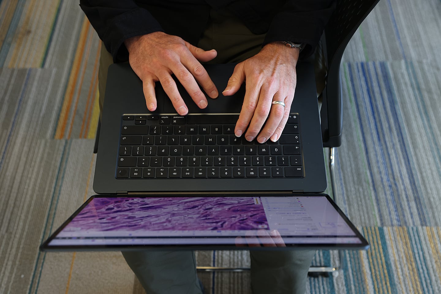 Andy Beck with an image of a cancer patient’s lung on his laptop.