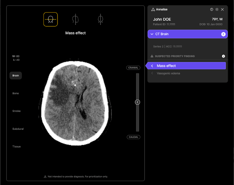 Australian health tech startup Harrison.ai scores $112M Series C | TechCrunch