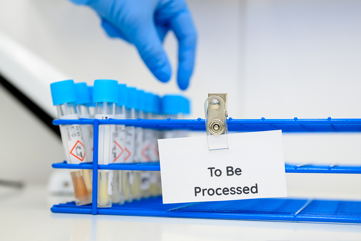 Startup Juno Bio raises $3.8m for smarter women’s diagnostics