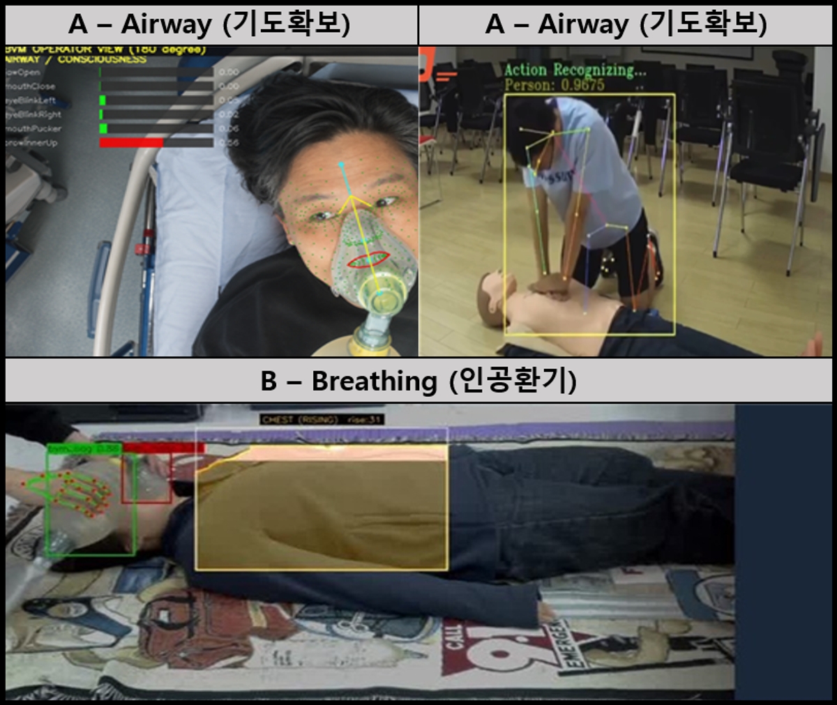 Life-or-Death Emergency Care: AI Rates It in Real Time With a Single Camera