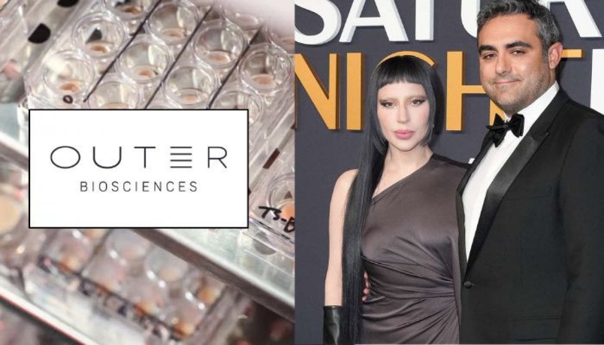 Lady Gaga’s fiance builds an AI skin health startup