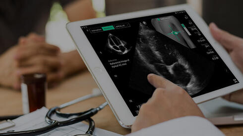 Israeli cardiac AI startup UltraSight raises $24 million to expand across US hospitals